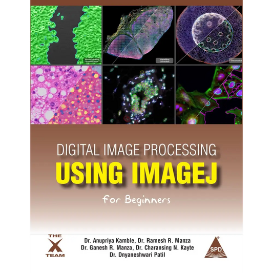 Digital Image Processing Using IMAGEJ For Beginners (Paperback)