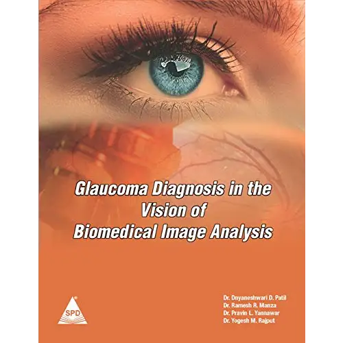 Glaucoma Diagnosis in the Vision of Biomedical Image Analysis